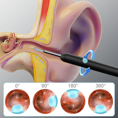 WIFI Visual Ohrenstäbchen HD1080P 4.2MM Mini-Kamera Ohrhörer Ohrenschmalzentferner Wireless Endoskop Gesundheitspflege Ohrenschmalzreinigung