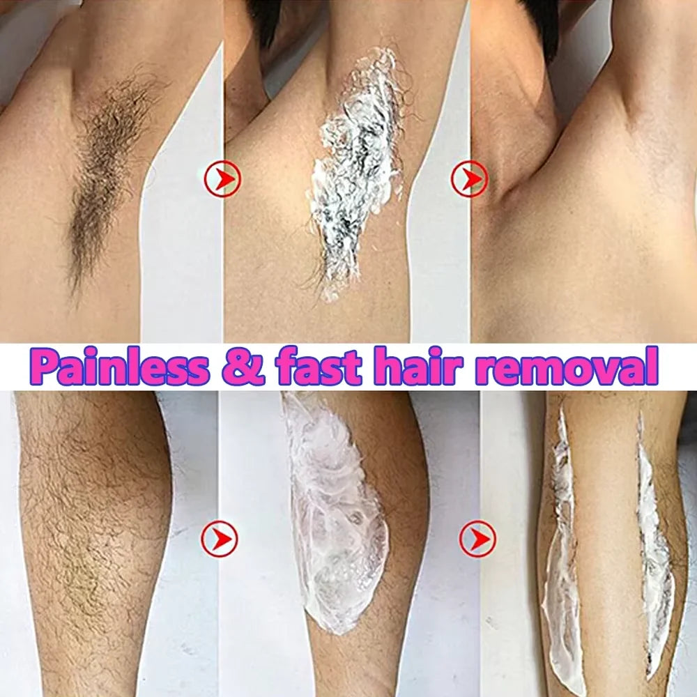 Haarentfernungscreme für Herren Dauerhafter Epilierer für den Intimbereich Schmerzfreier Haarentferner Wachstumshemmer Spray Geeignet für empfindliche Haut