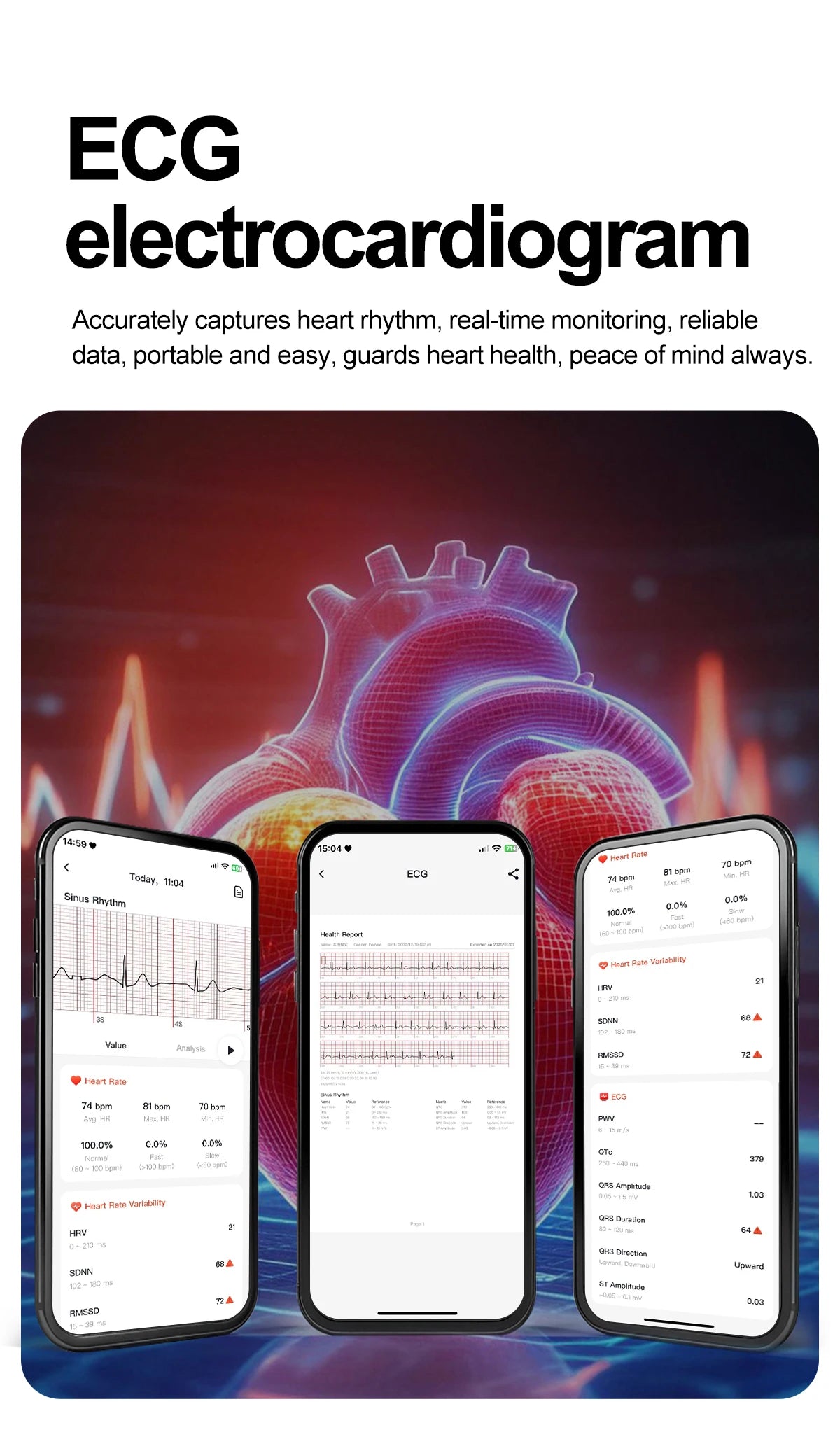 Neue Gesundheitsuhr Harnsäure Blutdruck Blutsauerstoff Körperanalyse Körperfett Smartwatch EKG+PPG Bluetooth Anruf Uhr Frauen Männer