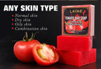 AILKE Bio-Tomaten-Seifenstück, hellt die Haut auf, reinigt tiefenwirksam, peelt, entfernt dunkle Flecken, spendet Feuchtigkeit, für Gesicht und Körper, 200 g