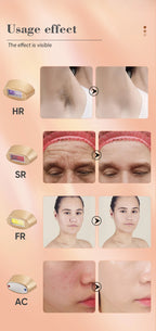 KODO 2026 High-End Personalisierung Eis Laser Haarentfernung Laser Epilierer Permanent IPL Schmerzloser Fotoepilierer 4 in 1 für Gesicht und Körper