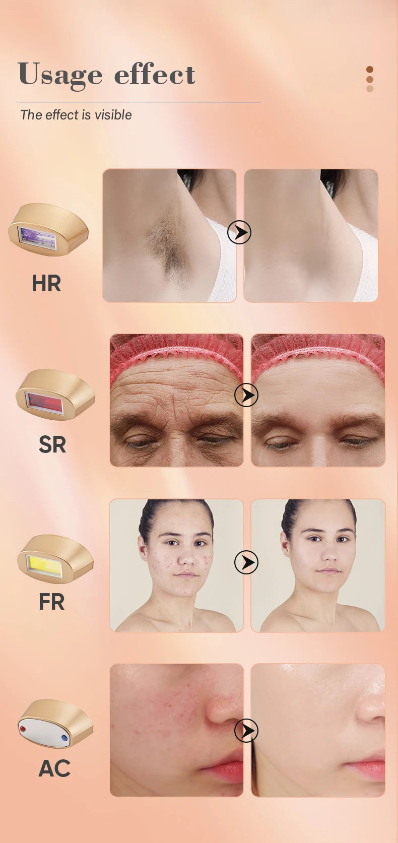 KODO 2026 High-End Personalisierung Eis Laser Haarentfernung Laser Epilierer Permanent IPL Schmerzloser Fotoepilierer 4 in 1 für Gesicht und Körper