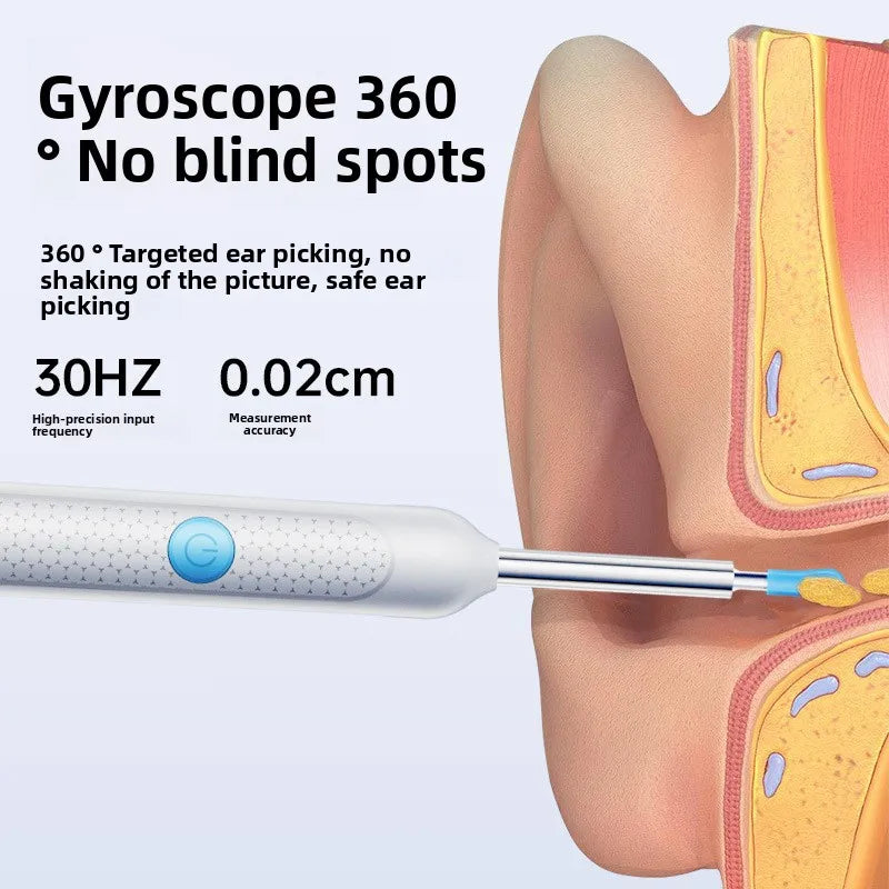 Visueller Ohrenschmalzentferner mit Kamera Sicherer Ohrenschmalz-Entfernungs-Endoskop mit 5M-Kamera Leuchtendes Otoskop Ohrenreinigungs-Tools Ohrenpflege