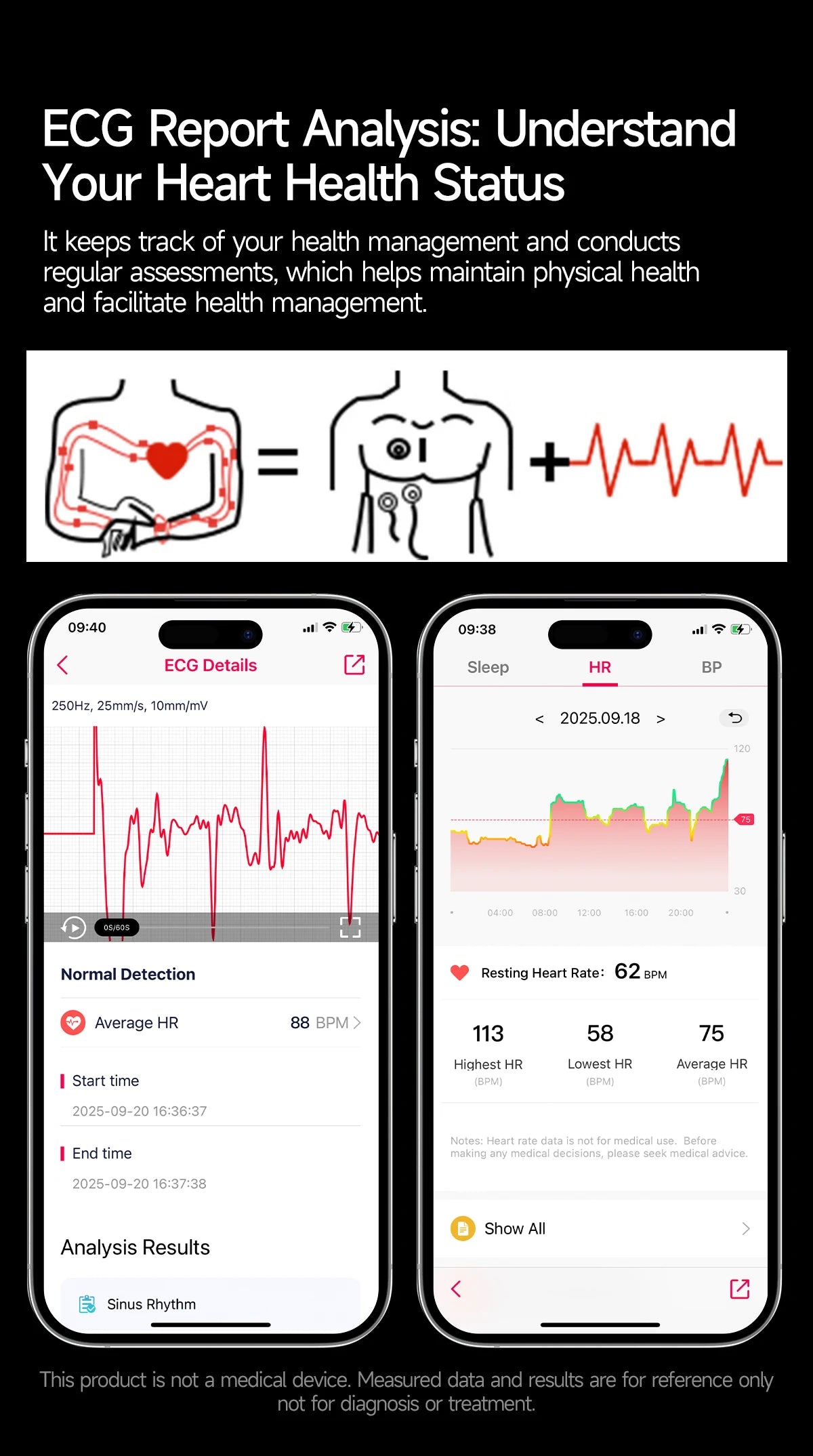 2026 Neue Mikrophysikalische Untersuchung Gesundheits-Smartwatch Herren EKG Harnsäure Lipide Blutdruck BT Anruf Smartwatch Für Android IOS