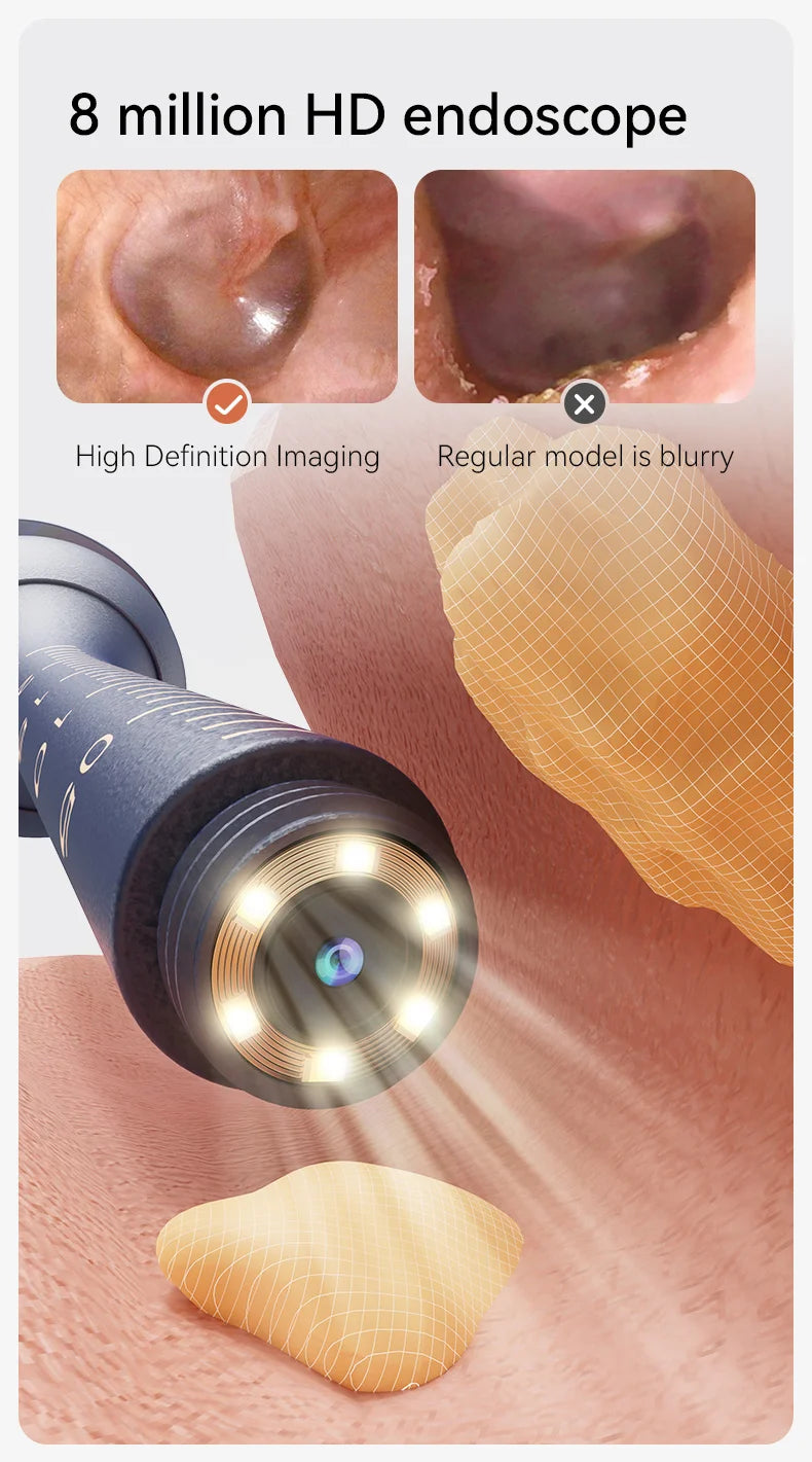 Verbesserter Smart Visual Ohrenschmalz-Entferner mit Kamera 800W HD Endoskop Multifunktionales Visuelles Ohrenreinigungsgerät Inklusive Aufbewahrung