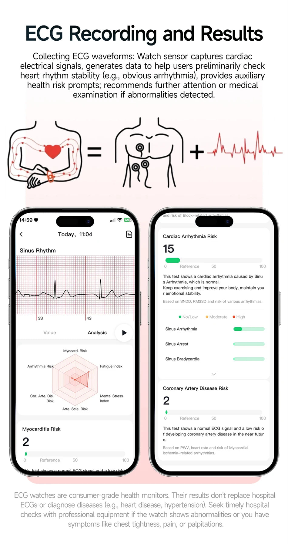 Neue Herren Smartwatch für präzise Gesundheitsdiagnose: EKG, Blutdruck, Blutsauerstoff, Blutfett, Harnsäure, Temperatur, Bluetooth-Anruf