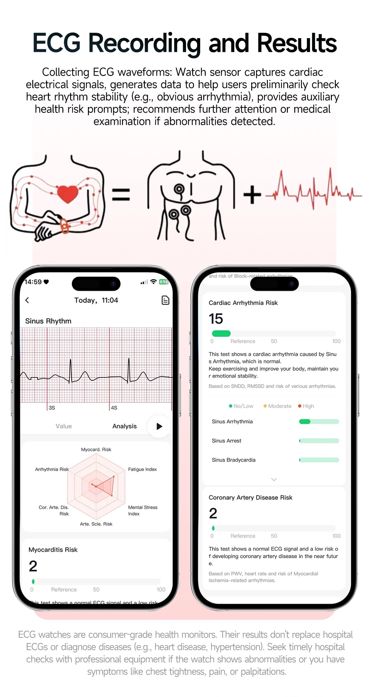 Neue präzise Gesundheits-Smartwatch EKG+HRV Harnsäure Blutfette Emotionswahrnehmung Bluetooth-Anruf Smartwatches für Männer und Frauen