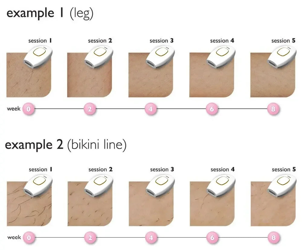 500000 Flash Schmerzloser Laser IPL Epilierer Damen Rasierer Permanente Haarentfernung Für Körper Gesicht Bikini Achselhöhle Haarentfernungsgerät