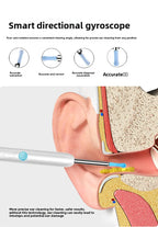 Visueller Ohrenschmalzentferner mit Kamera Sicherer Ohrenschmalz-Entfernungs-Endoskop mit 5M-Kamera Leuchtendes Otoskop Ohrenreinigungs-Tools Ohrenpflege