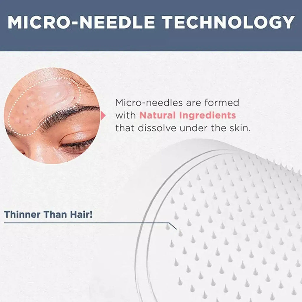 5/10/30 STÜCK Microneedle Augenpads Maske Koreanische Hautpflege Hyaluronsäure gegen Faltenbildung Alterung Augenringe Augenmaske Feuchtigkeitsspendend