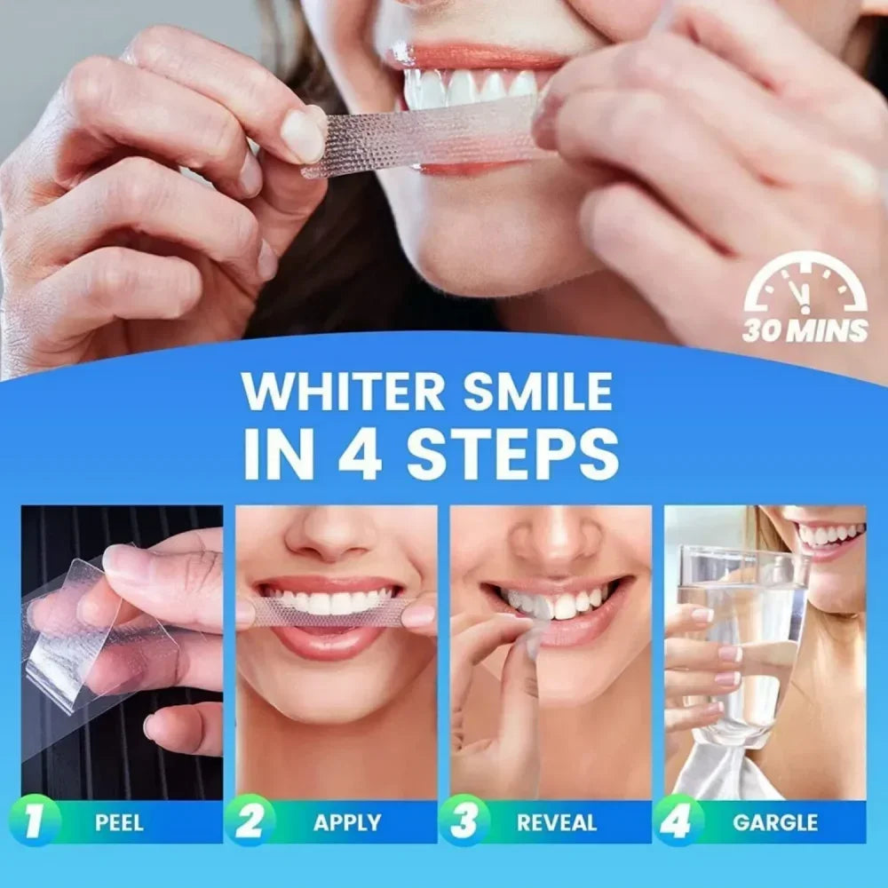 Zahnaufhellungsstreifen, weißes Zahnarzt-Kit, Mundhygiene-Pflegestreifen für Zahnveneers, Zahnarzt-Aufhellungsstreifen 3D/5D/9D