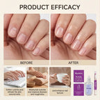 1/2er-Set Nagelhäutchenpflege-Kit, Nagelhaut-Erweichungsöl, Nagelhautentferner für Gel, überwachsene Nagelhaut erweichen, Peeling für Nägel