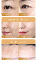 10 Stk. Kollagen Anti-Falten Gesichtsmaske Anti-Aging Mildert feine Linien Strafft die Haut Feuchtigkeitsspendend Aufhellend Hautpflege Koreanische Kosmetik