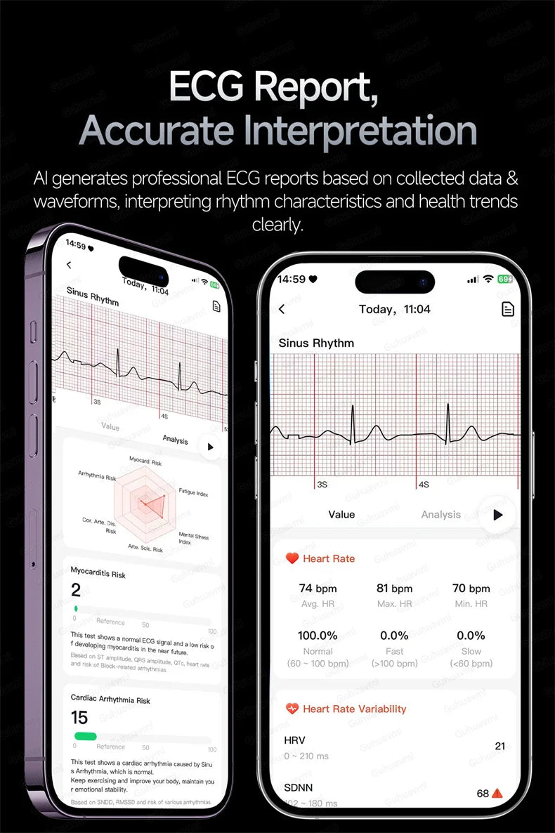 EKG High-End Gesundheits-Smartwatch Herren Blutdruck Lipide Blutsauerstoff Körperanalyse Harnsäure Gesundheitstracker Smartwatch Herren Damen