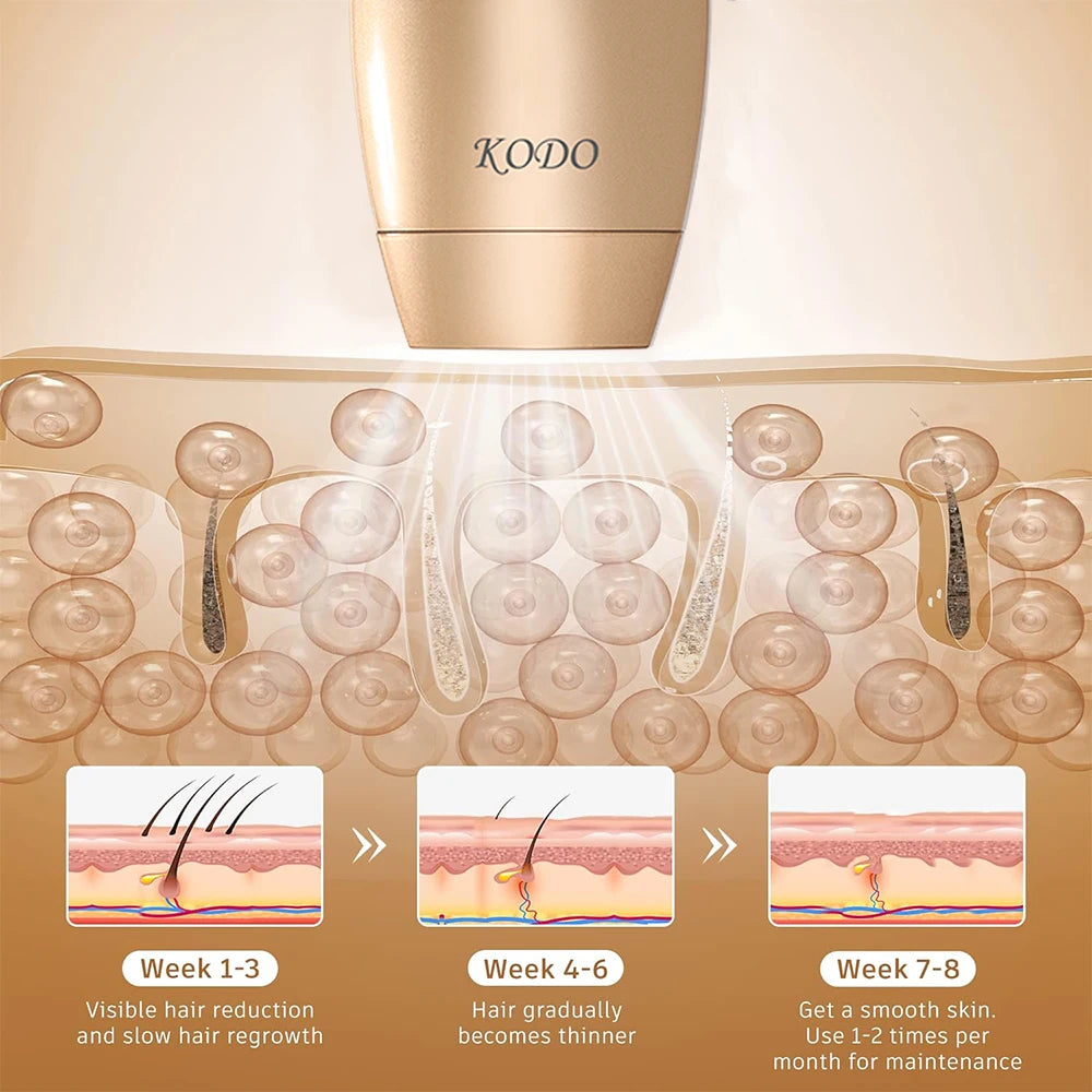 KODO 2026 High-End Personalisierung Eis Laser Haarentfernung Laser Epilierer Permanent IPL Schmerzloser Fotoepilierer 4 in 1 für Gesicht und Körper
