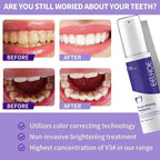2026 Meistverkaufte aufhellende Zahnpasta Verabschieden Sie sich von gelben Zähnen Mundhygiene Reinigung und Zahnpflege-Tool