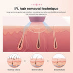Laser-Epilierer IPL Haarentfernung Laser-Epilierer für Frauen 500.000 Lichtimpulse Epiliergerät Dauerhafte Schmerzlose Haarentfernung