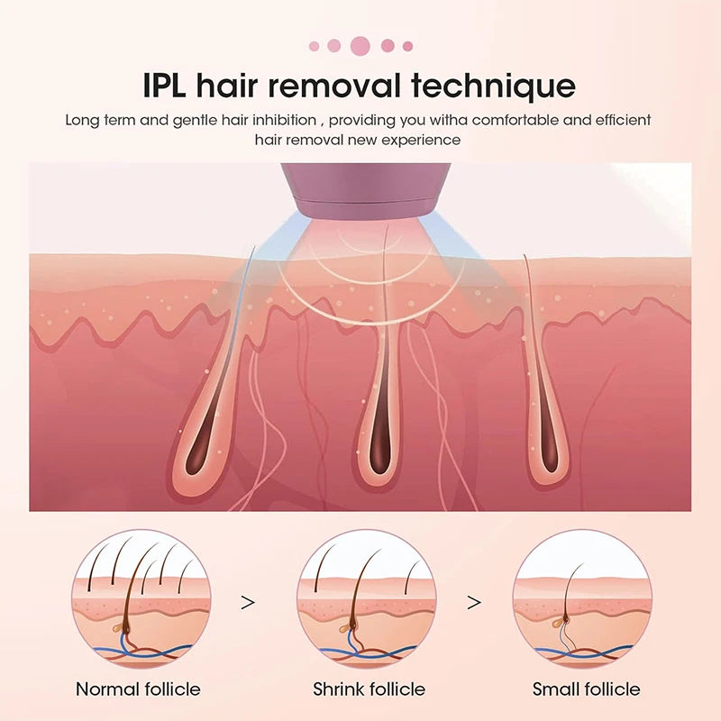 Laser-Epilierer IPL Haarentfernung Laser-Epilierer für Frauen 500.000 Lichtimpulse Epiliergerät Dauerhafte Schmerzlose Haarentfernung