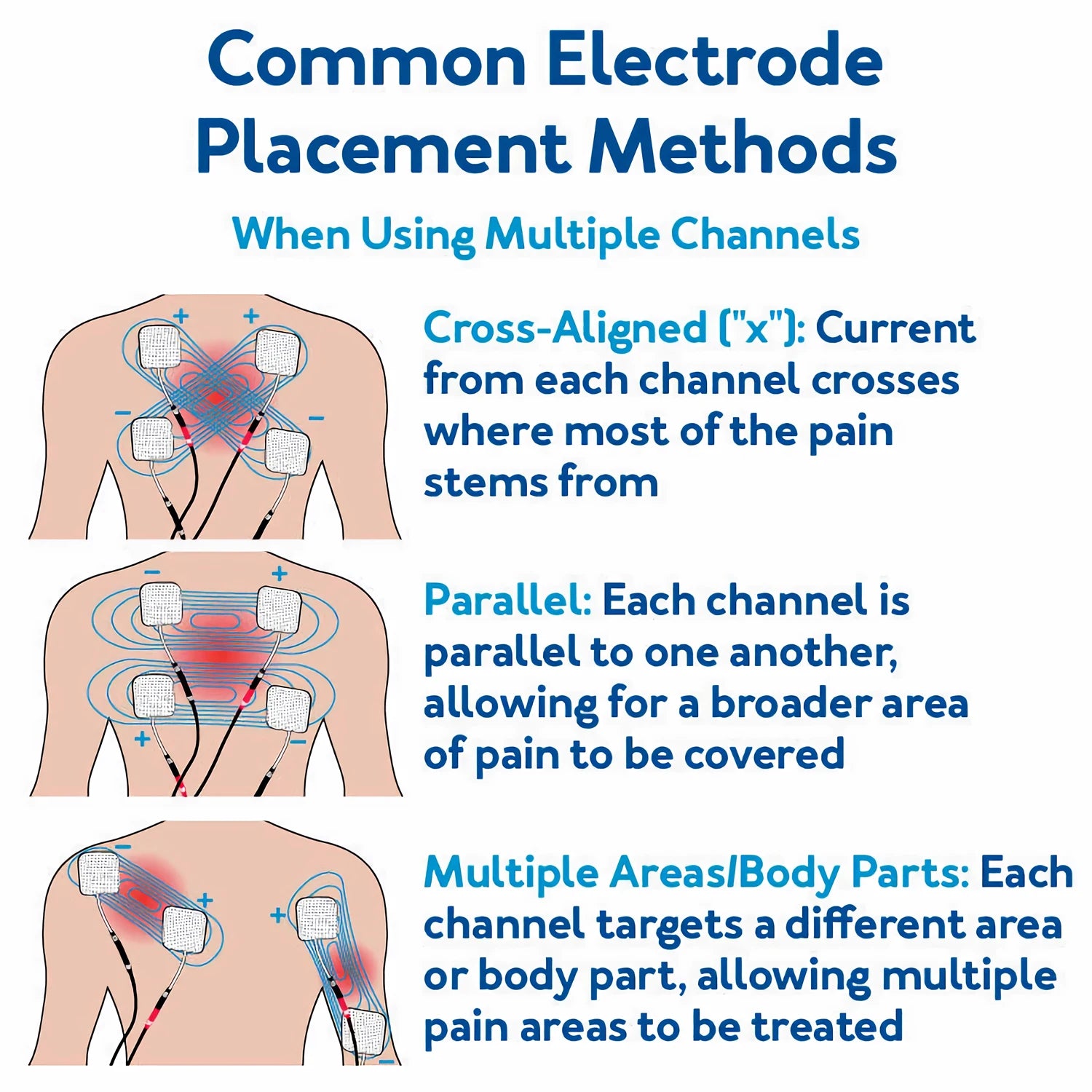 60 Massage-Modi 4-in-1-Elektromuskelstimulator-Kombination Physiotherapie 4000Hz EMS IFC RUSS TENS Impuls-Elektrostimulator