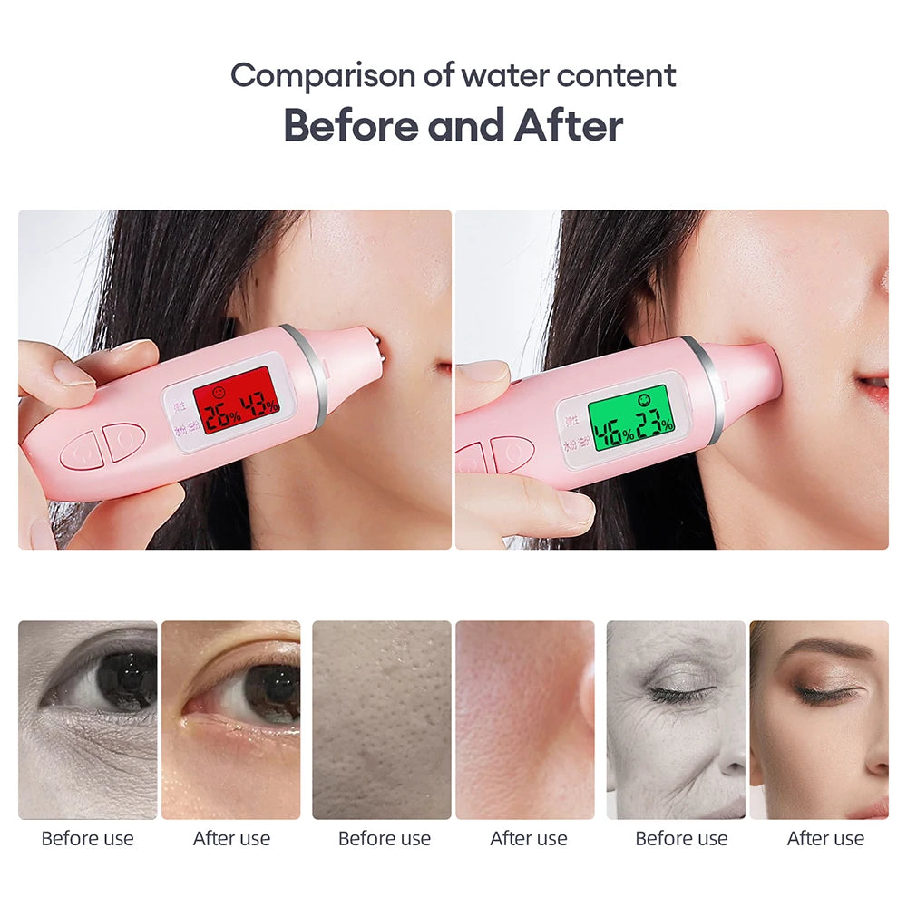 Tragbares Sauerstoff-Blasen-Gesichtsgerät CO2-Blasenstift Aqua Skin Gesichtsreinigungs-SPA-Schönheitsgerät CO2-Pod-Massagegerät