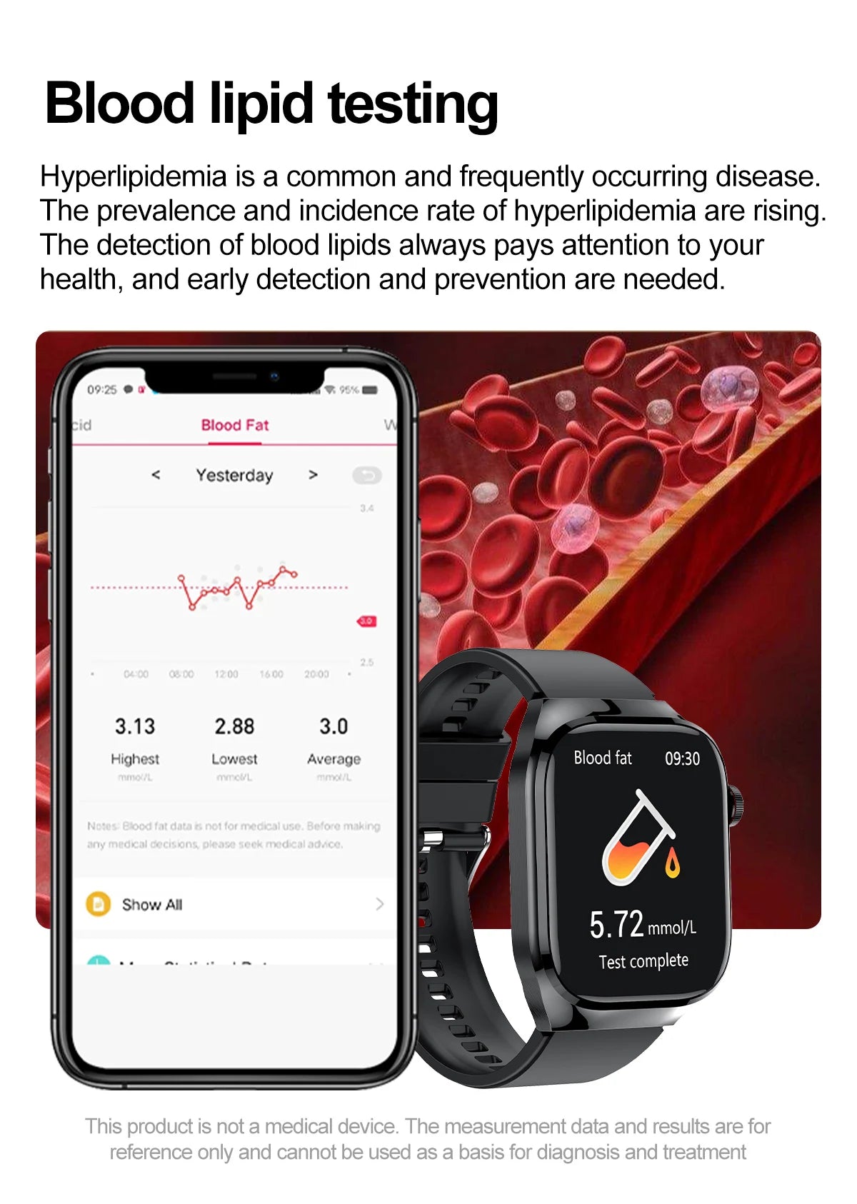 2026 Neue Pflegegrad-Harnsäure-Blutfettwerte Smartwatch Herren EKG+PPG Blutdruck Herzfrequenz Bluetooth Anruf Gesundheits-Smartwatch