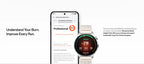 Globale Version OnePlus Watch Lite Smartwatch, 1,46 Zoll Display, 59g, 10 Tage zuverlässige Akkulaufzeit, Herzfrequenz, Blutsauerstoffüberwachung