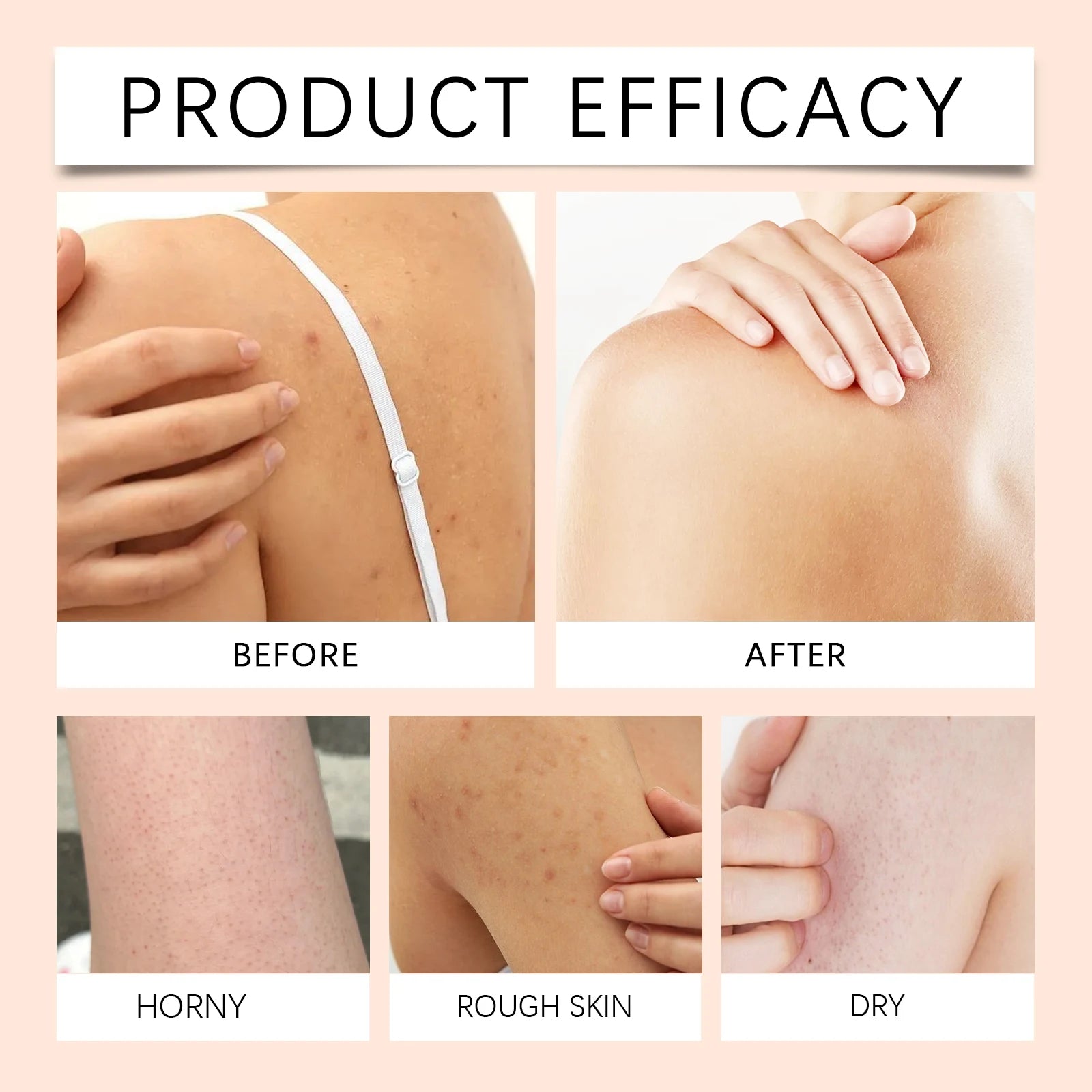 Papaya Whitening Duschgel Peeling Verblassen von Pigmentflecken Langanhaltender Duft Erfrischend Reguliert Öl Feuchtigkeitsspendend Reichhaltiger Schaum Körperwaschmittel