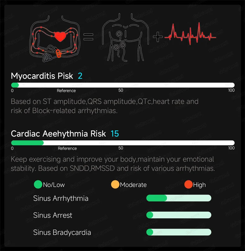 EKG High-End Gesundheits-Smartwatch Herren Blutdruck Lipide Blutsauerstoff Körperanalyse Harnsäure Gesundheitstracker Smartwatch Herren Damen