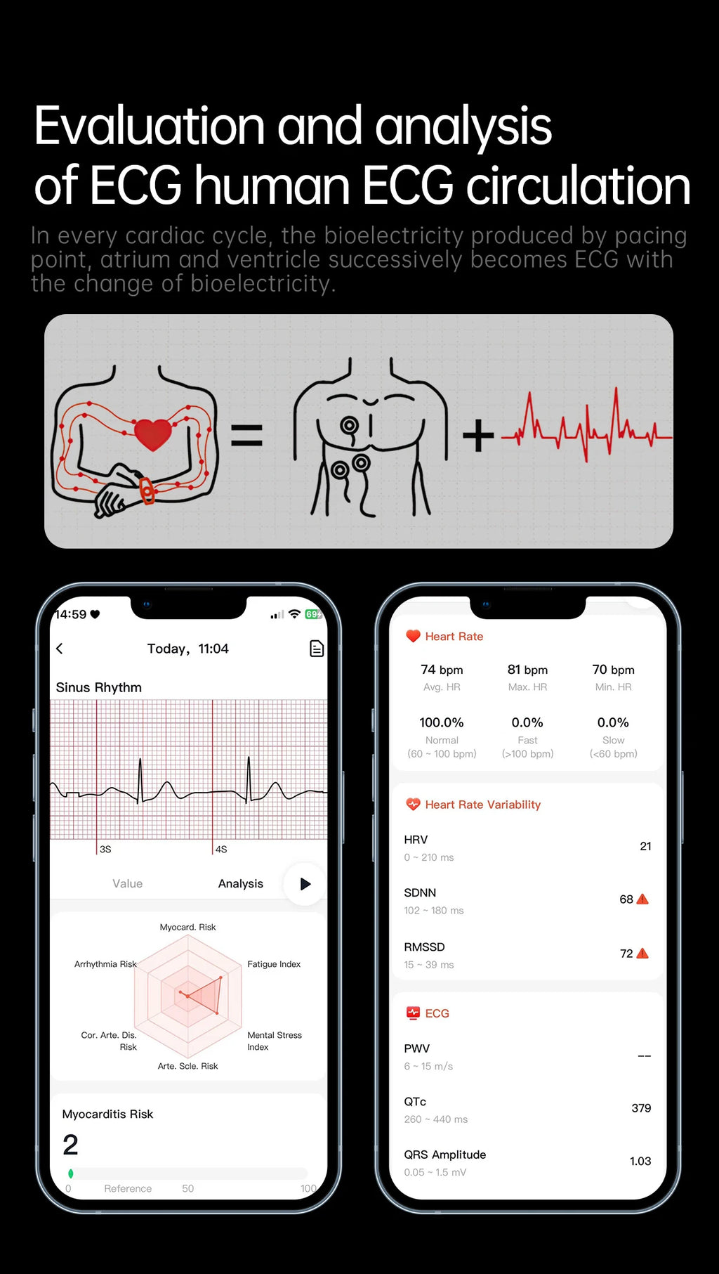 2026 Neue Smartwatch für Pflegeberufe mit EKG+PPG Gesundheitsanalyse Blutdruck Lipide Harnsäure Drahtlose HD-Anruf Smartwatch Herren Damen