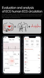 2026 Neue Smartwatch für Pflegeberufe mit EKG+PPG Gesundheitsanalyse Blutdruck Lipide Harnsäure Drahtlose HD-Anruf Smartwatch Herren Damen