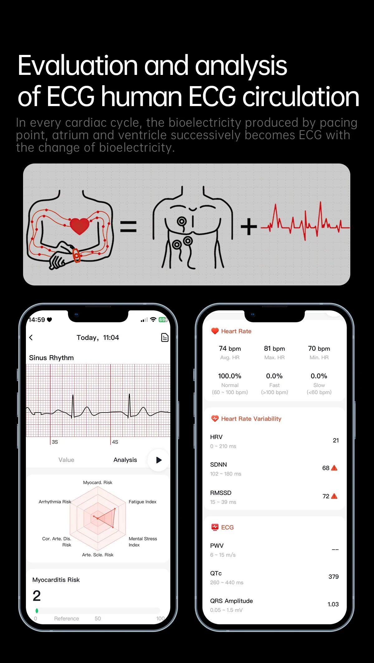 2026 Neue Smartwatch für Pflegeberufe mit EKG+PPG Gesundheitsanalyse Blutdruck Lipide Harnsäure Drahtlose HD-Anruf Smartwatch Herren Damen