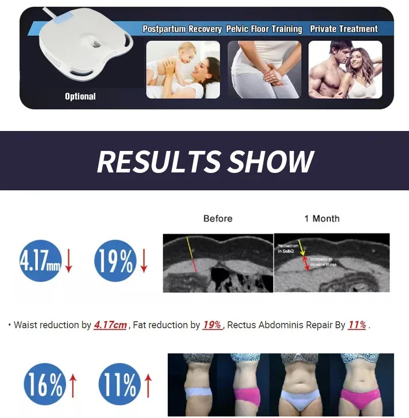 Neueste Myoslim Neo RF EMS Body Sculpting Maschine 6500W HI-EMT Muskelstimulator Po-Lifting Massagegerät zur Körperformung