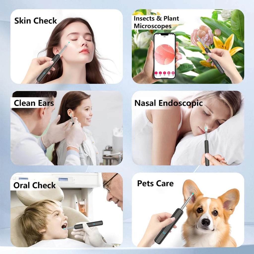 Intelligenter visueller Ohrenreiniger HD Ohrenstäbchen Otoskop USB-C-Ladeendoskop Ohrenschmalzentferner Ohrenschmalz-Entfernungswerkzeug Ohrenschmalz-Minikamera Gesundheitspflege-Set