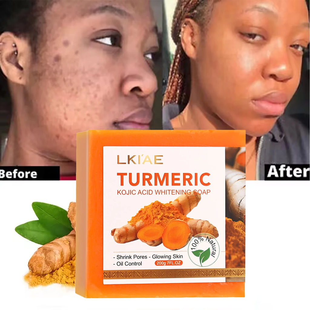 LKIAE Bio-Kurkuma-Seife, natürliche Kräuter-Handgemachte Aufhellungsseife, entfernt Melanin, Akne, Flecken, für Gesicht und Körper, 200g