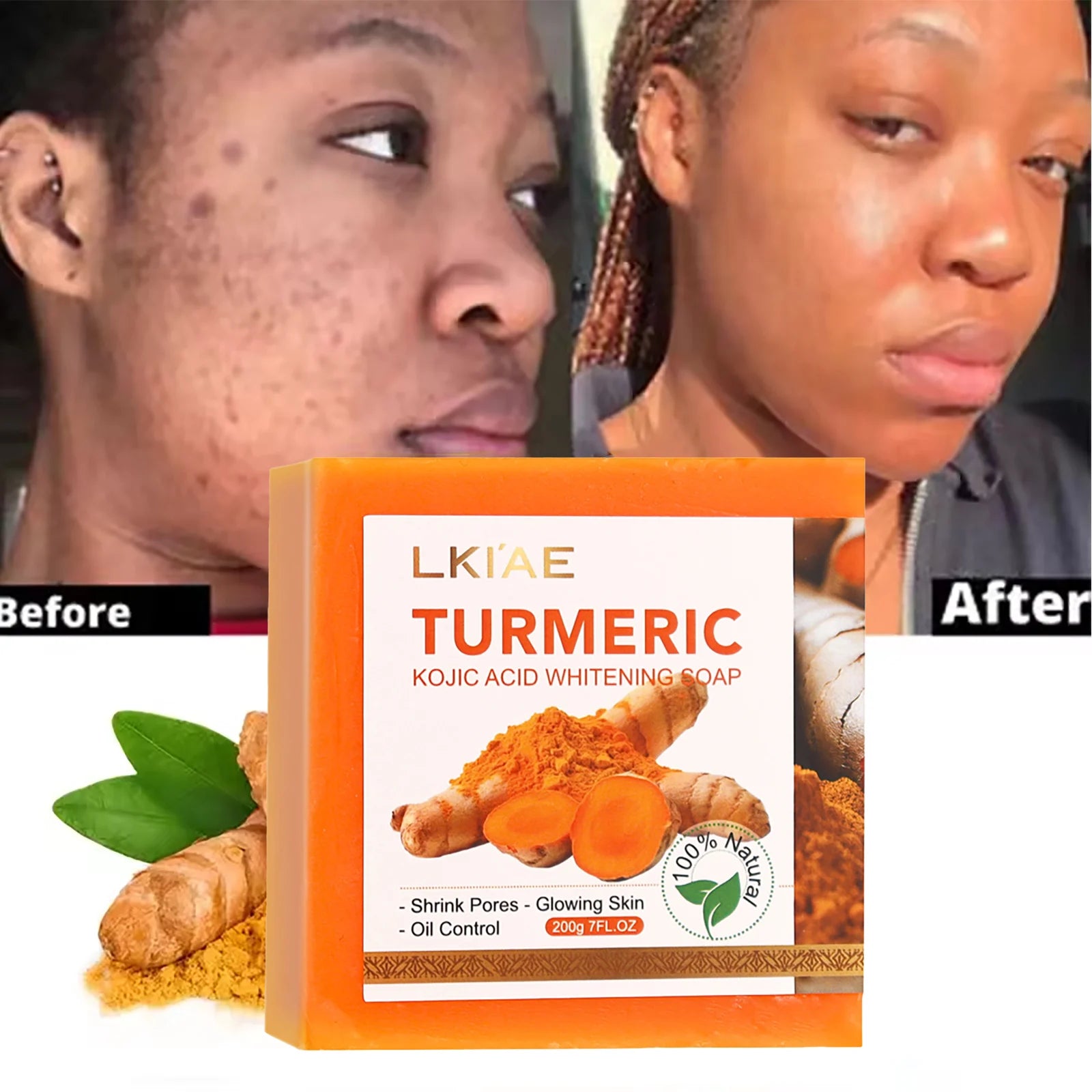 LKIAE Bio-Kurkuma-Seife, natürliche Kräuter-Handgemachte Aufhellungsseife, entfernt Melanin, Akne, Flecken, für Gesicht und Körper, 200g Hauptbild