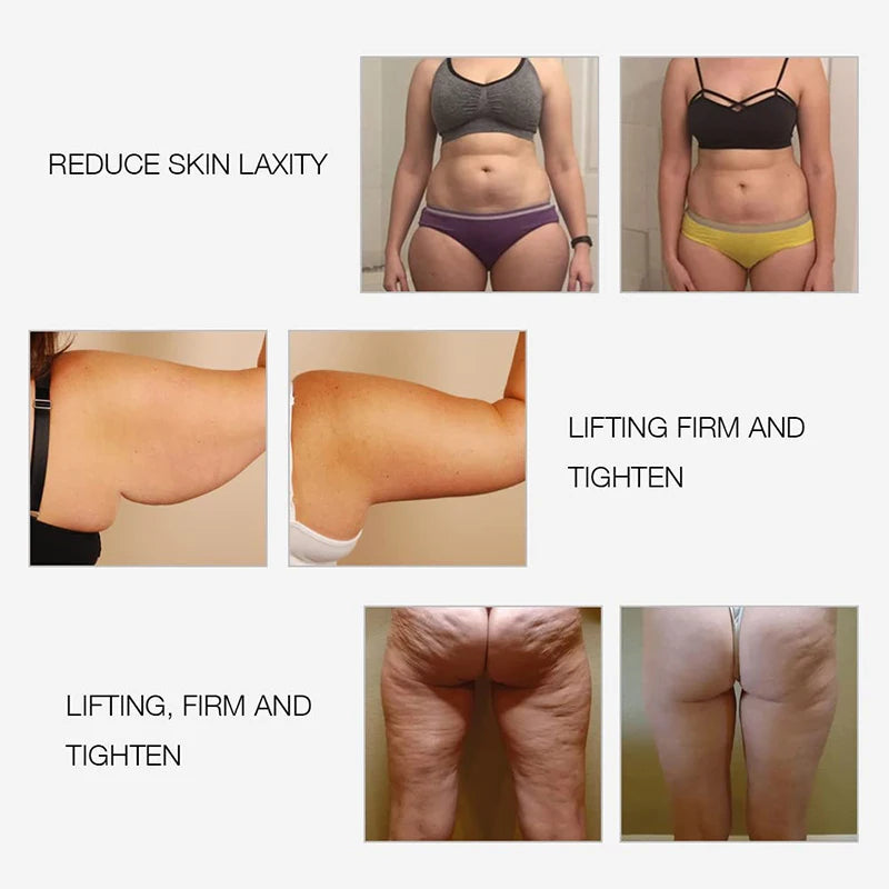 EMS & RF Radiofrequenz Körperschlankheitsgerät Fettverbrenner Schlankheitsformer LED-Lichttherapie Abnehmen Cellulite-Massagegerät