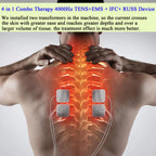 60 Massage-Modi 4-in-1-Elektromuskelstimulator-Kombination Physiotherapie 4000Hz EMS IFC RUSS TENS Impuls-Elektrostimulator