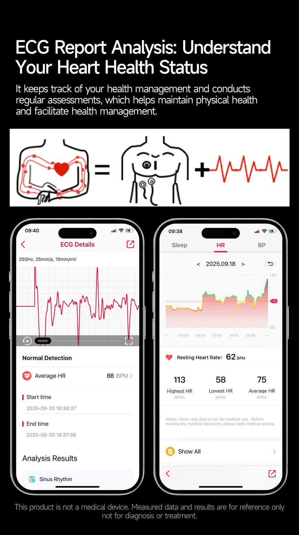 Neue genaue EKG-Smartwatch, Blutfettwerte, Fünf-Organe-Gesundheitscheck, Körpertemperatur, BT-Anruf, Sport-Smartwatches für Herren 2026