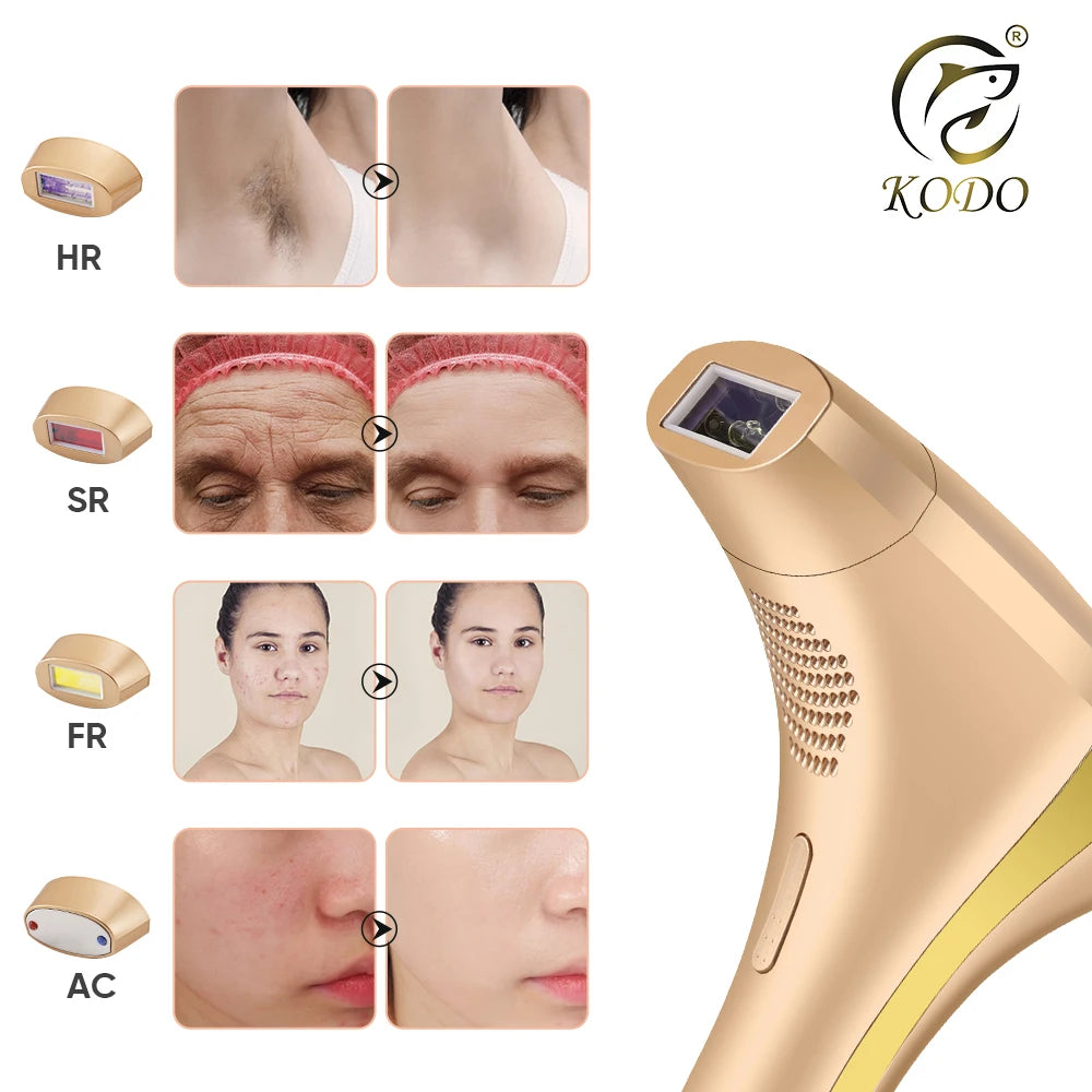KODO 2026 High-End Personalisierung Eis Laser Haarentfernung Laser Epilierer Permanent IPL Schmerzloser Fotoepilierer 4 in 1 für Gesicht und Körper